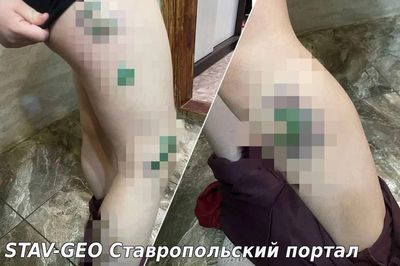 Собаки снова напали на ребёнка – теперь в Михайловске