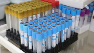 Особых мер предосторожности против нового вида COVID-19 не требуется — вирусолог